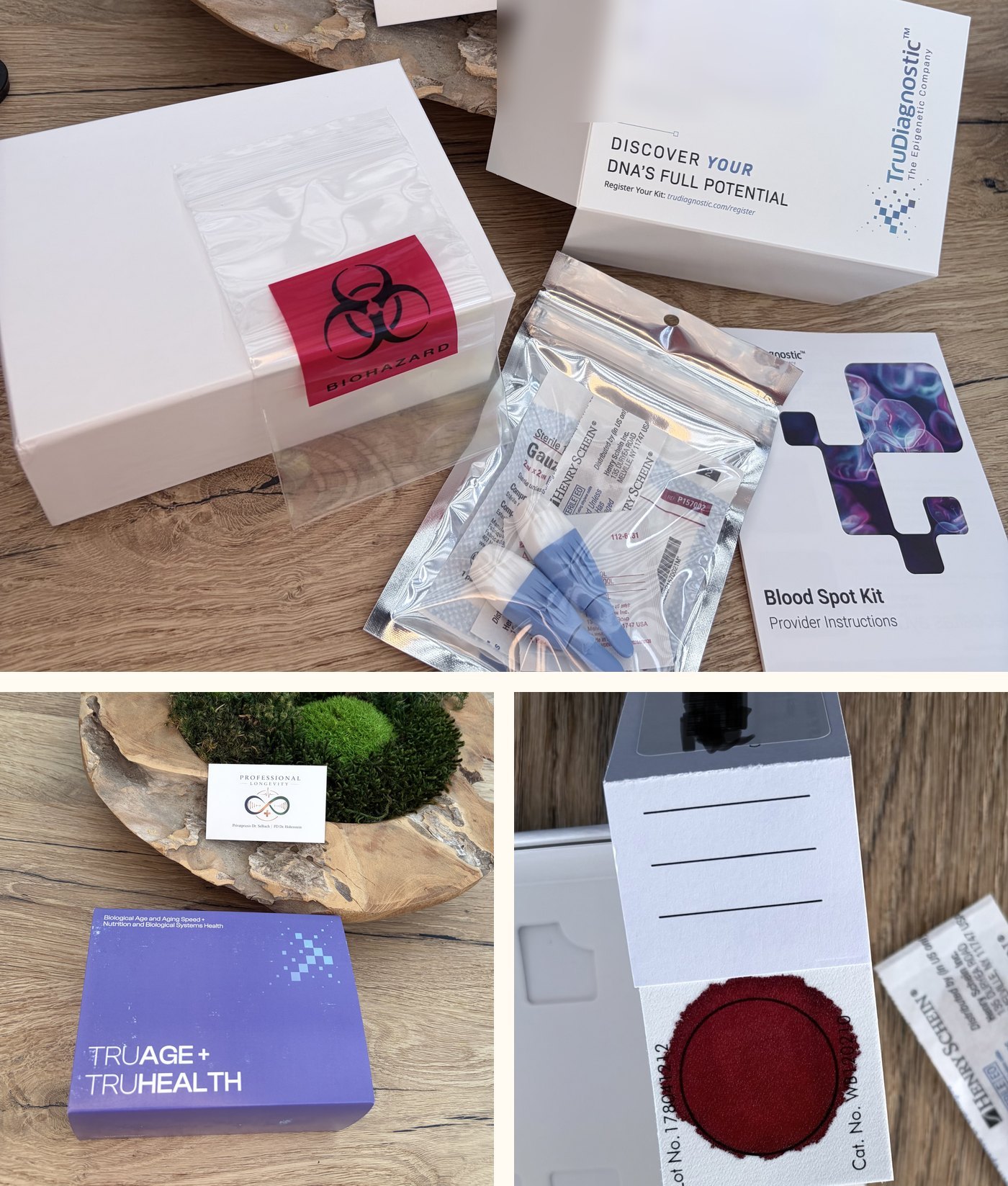 Epigenetisches Testkit TruAge + TruHealth in der Praxis: geöffnetes TruDiagnostic Blood-Spot-Kit mit Lanzette, sterilem Zubehör und Anleitung; verschlossene Testbox; Trockenblutkarte nach der Entnahme