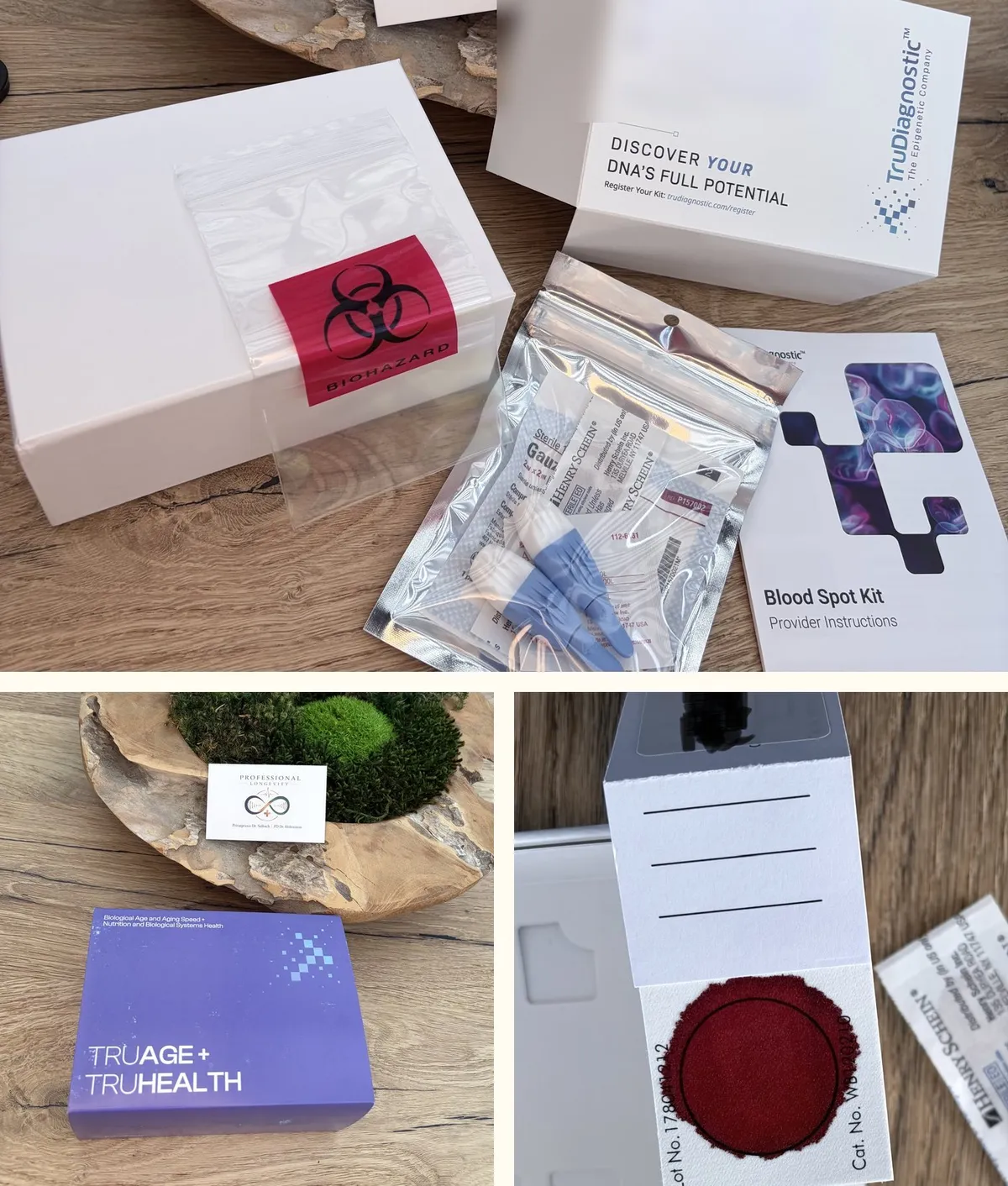 Epigenetisches Testkit TruAge + TruHealth in der Praxis: geöffnetes TruDiagnostic Blood-Spot-Kit mit Lanzette, sterilem Zubehör und Anleitung; verschlossene Testbox; Trockenblutkarte nach der Entnahme