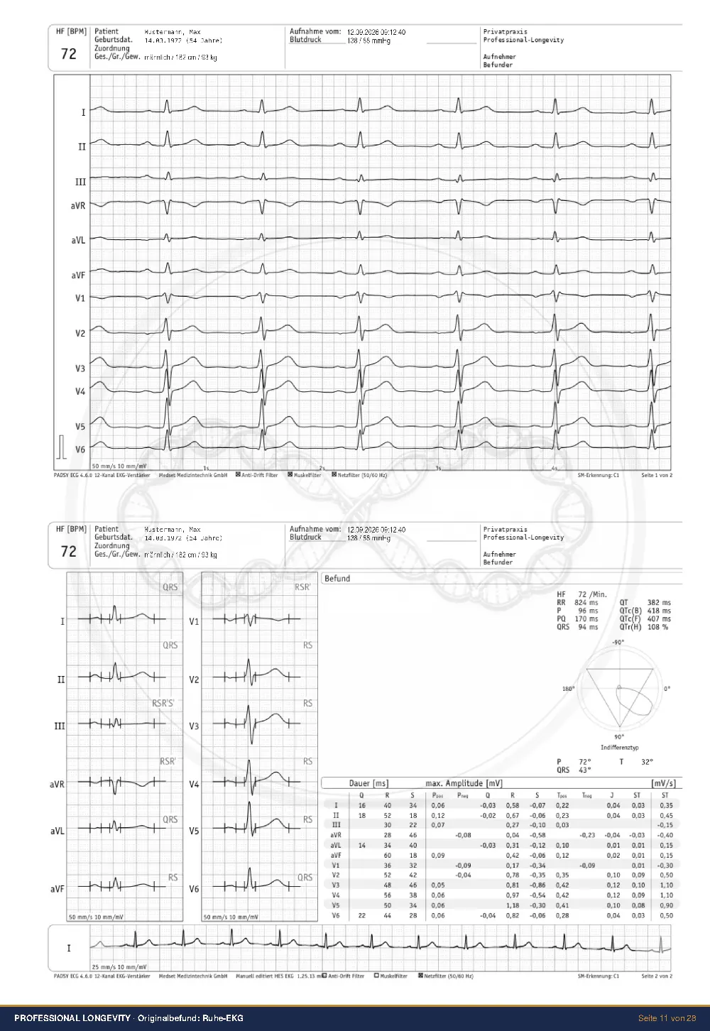 Ruhe-EKG — Originalbefund
